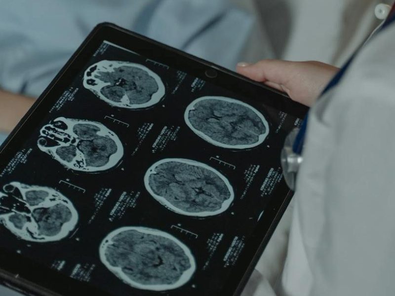 Living and Dying with&nbsp;Dignity